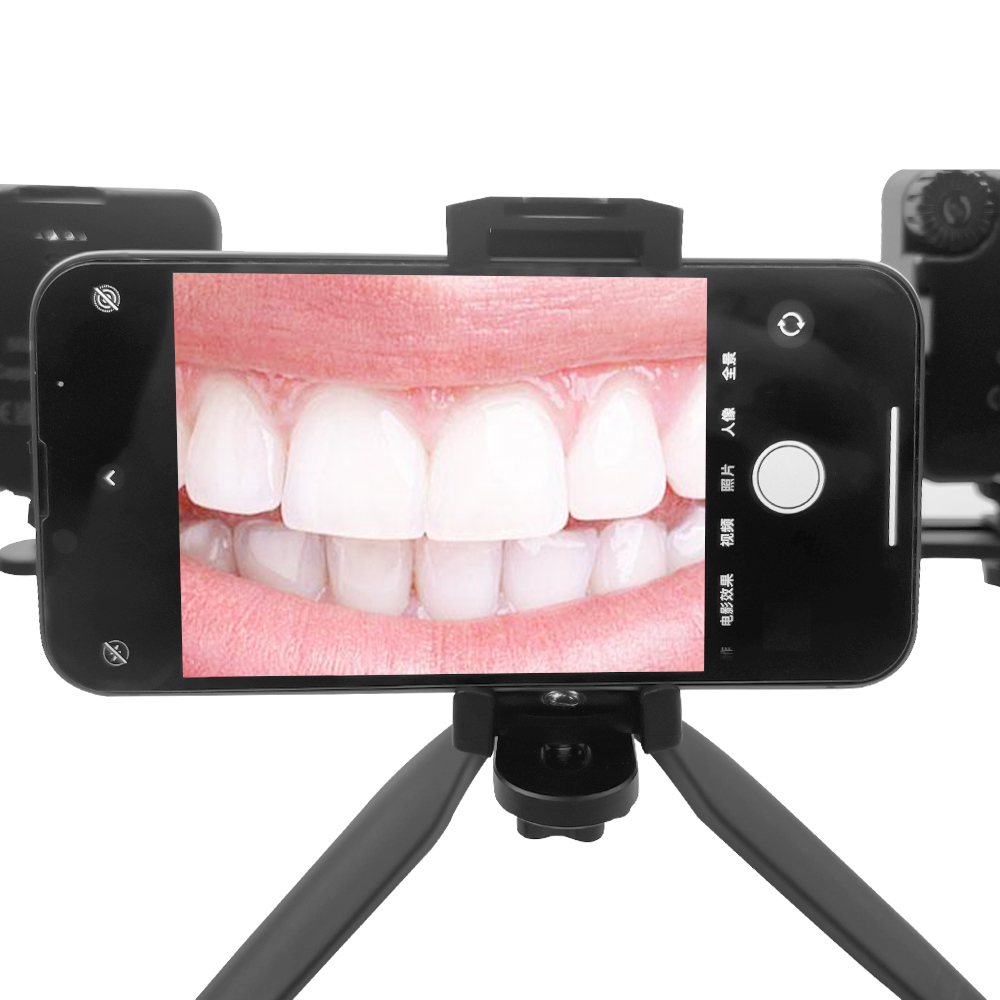 Dental Photography Light Intra - Photography Mobile Lighting 评论和价格