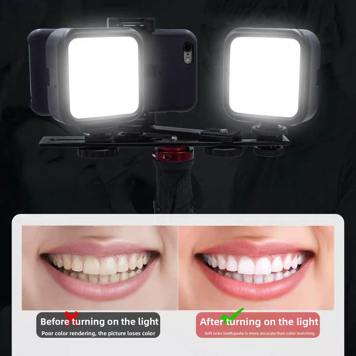 Dental Photography Light with  - Photography Mobile Lighting 评论和价格
